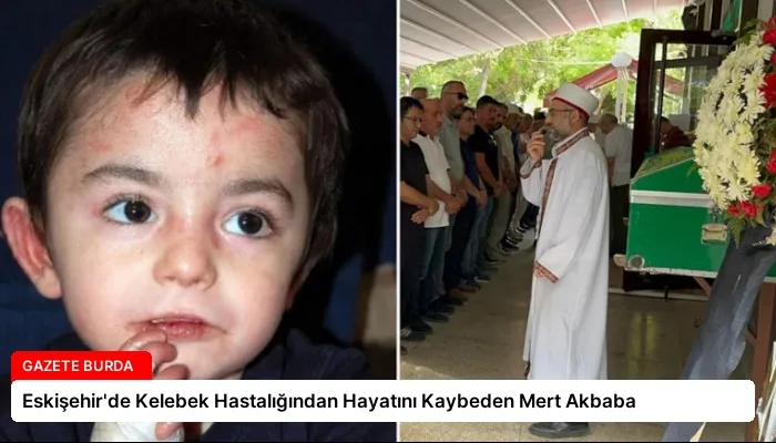 Eskişehir’de Kelebek Hastalığından Hayatını Kaybeden Mert Akbaba