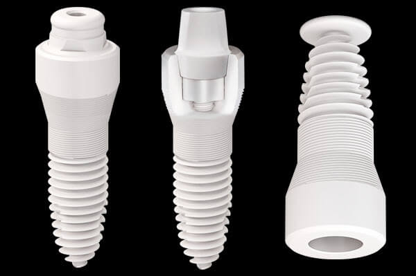  Zigoma İmplant Fiyatları ve Tedavi Süreci: Bilmeniz Gereken Her Şey